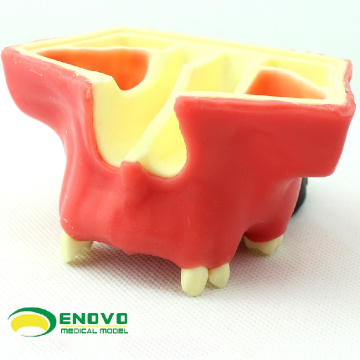 IMPLANT07 (12615) Modelo de práctica de estiramiento dental sinusal utilizado para la práctica